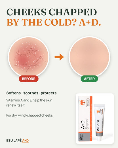 A+D cream before and after