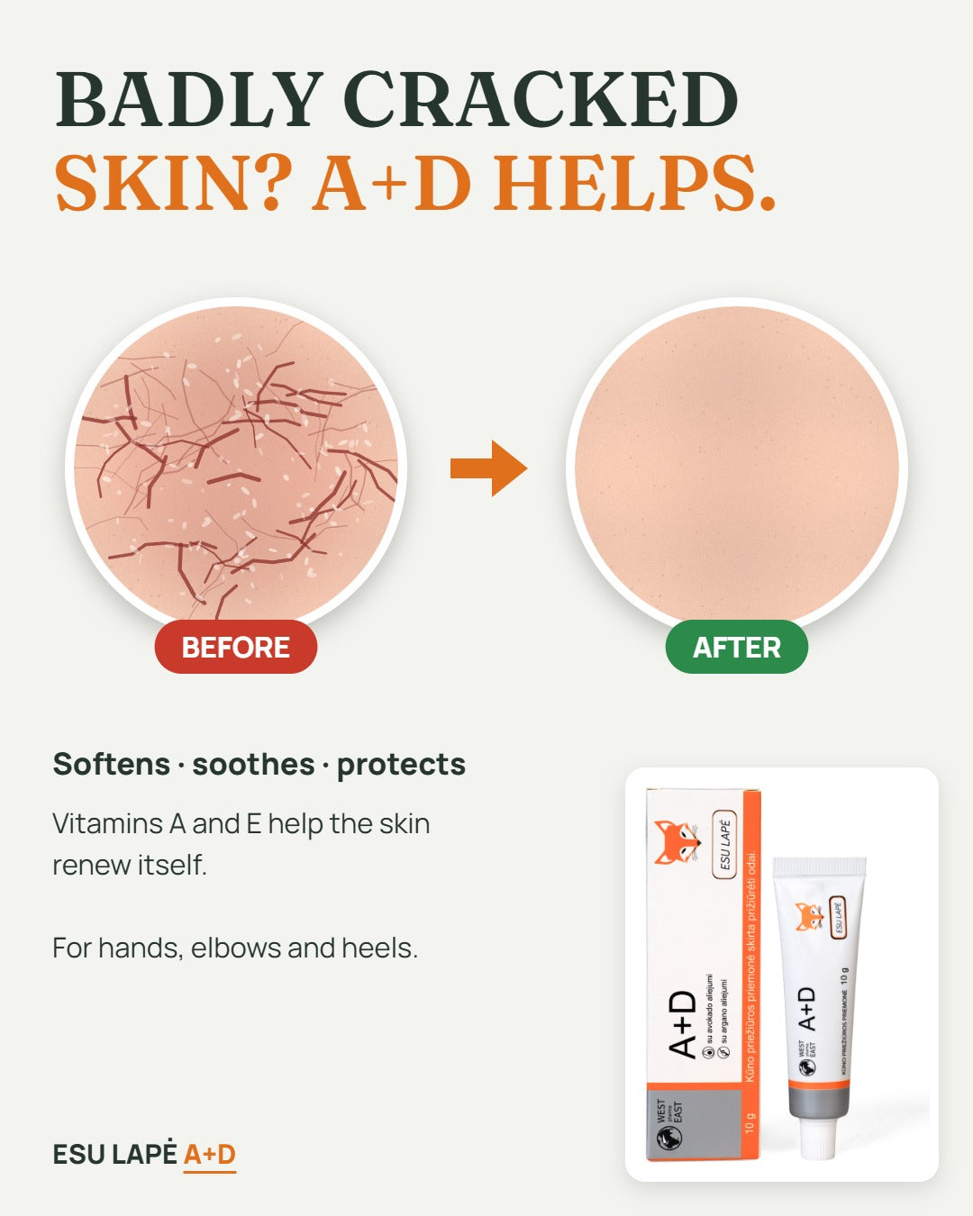 A+D cream before and after