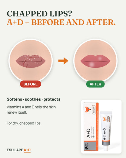 A+D cream before and after