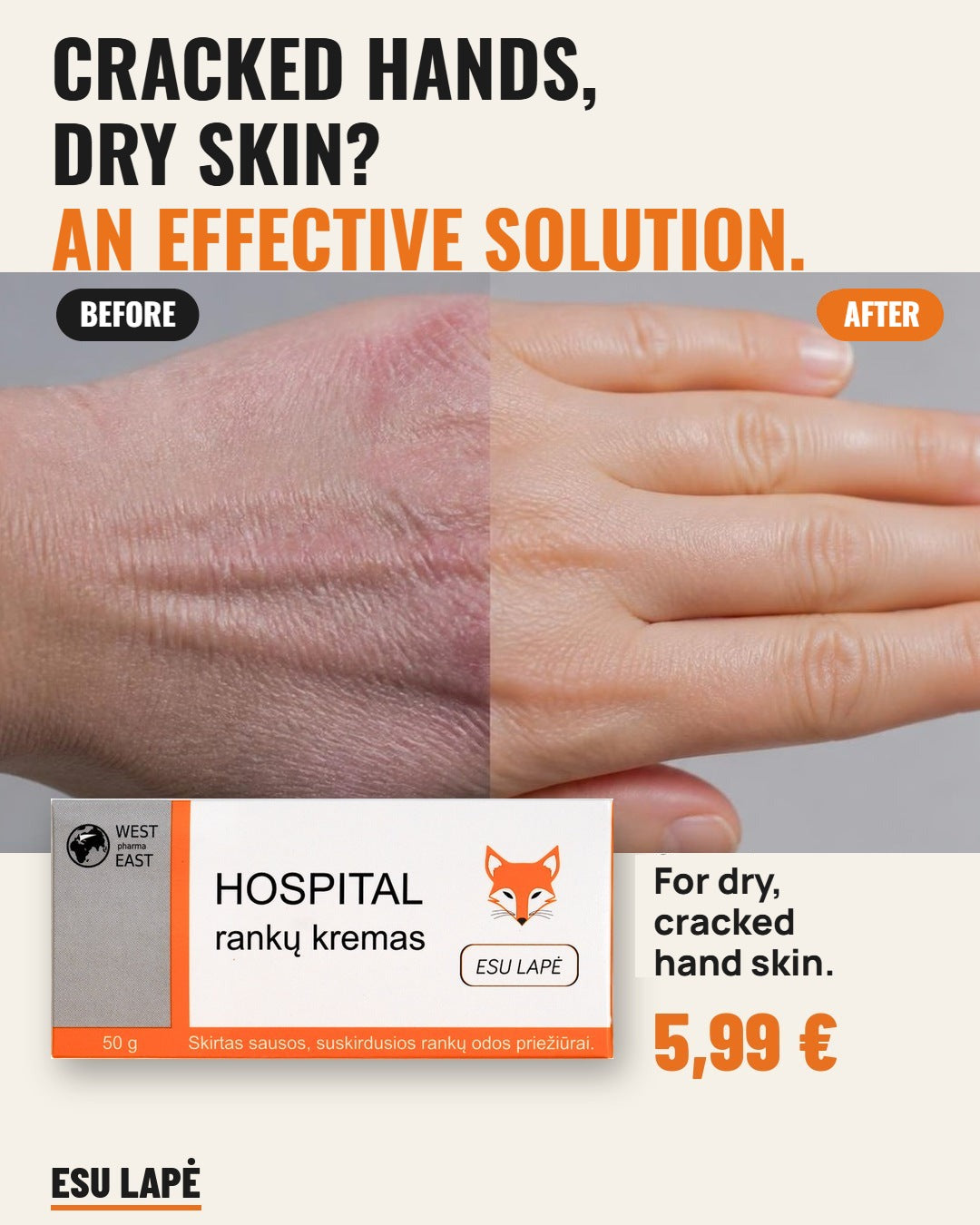 Hospital hand cream before and after