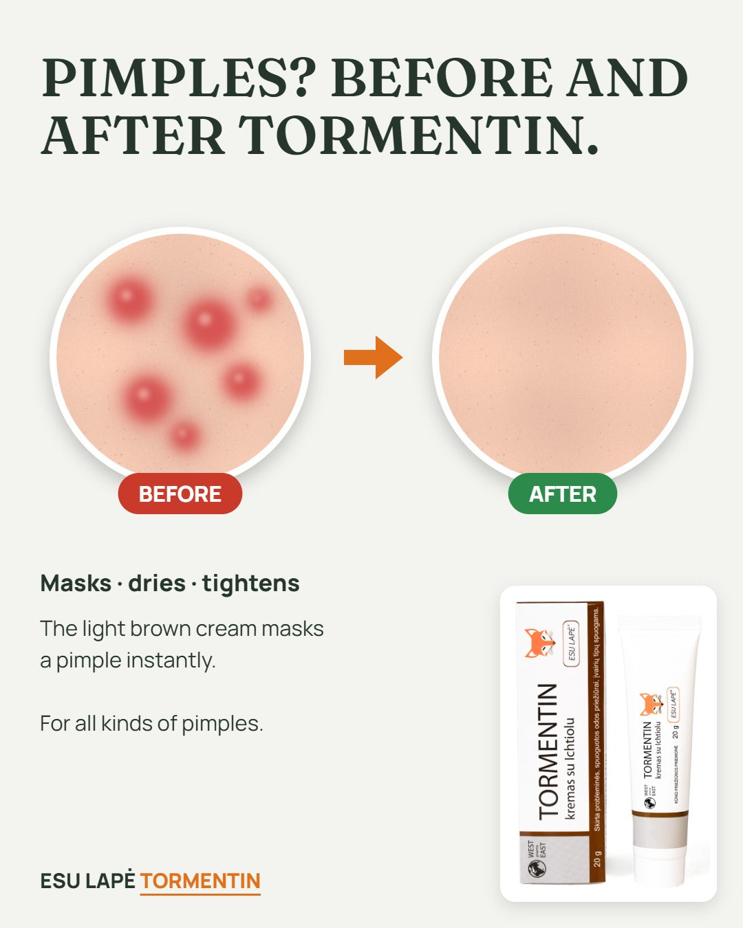 Tormentin before and after