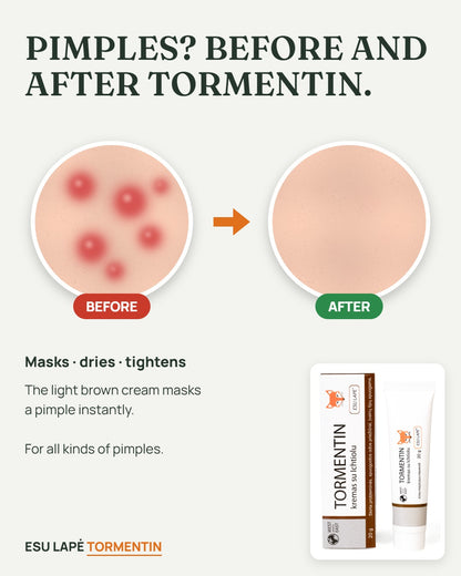 Tormentin before and after