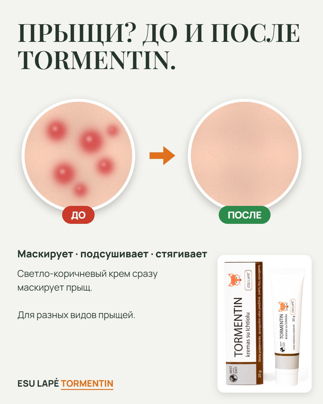 Крем TORMENTIN, ESU LAPĖ