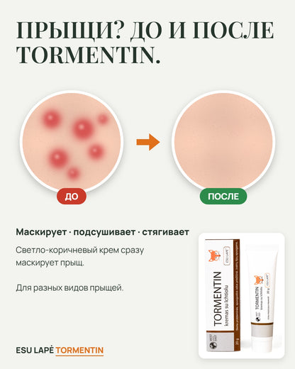 Крем TORMENTIN, ESU LAPĖ