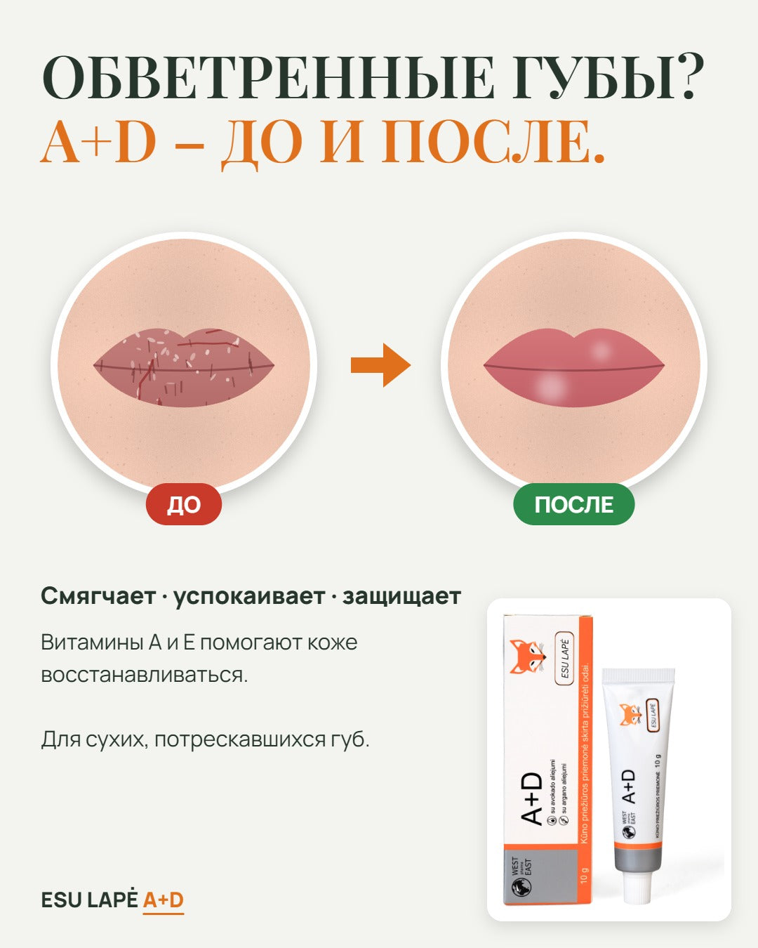 Buy 3, Get 1 Free – A+D Cream, ESU LAPĖ (4 pcs)