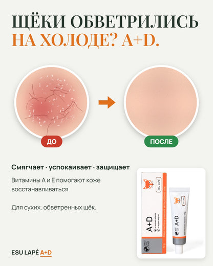 Buy 3, Get 1 Free – A+D Cream, ESU LAPĖ (4 pcs)